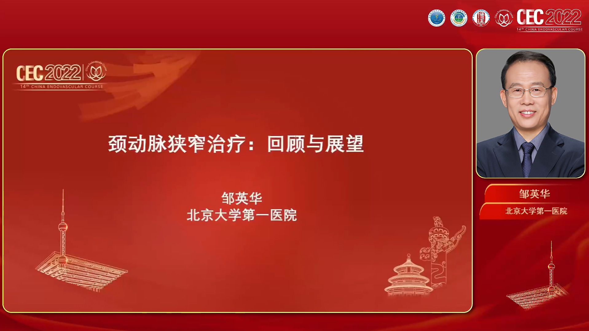 邹英华：颈动脉狭窄治疗：回顾与展望.jpg